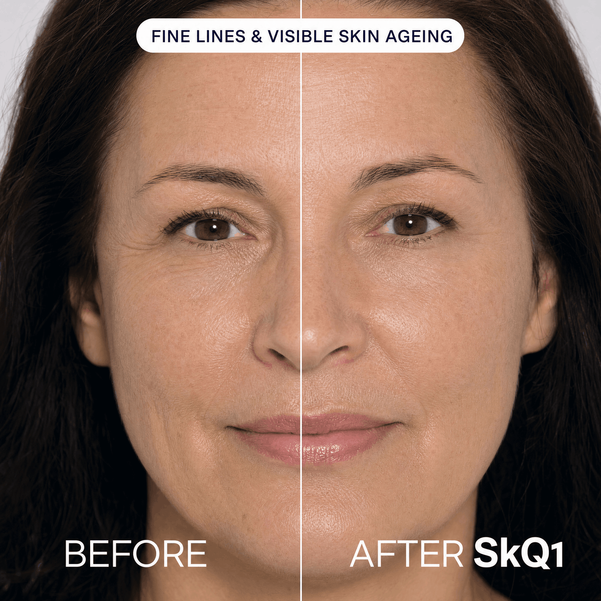 SKQ1 Serum