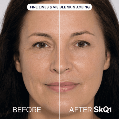 SKQ1 Serum