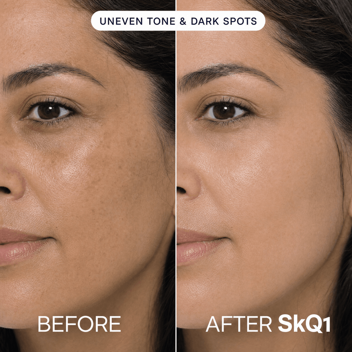 SKQ1 Serum