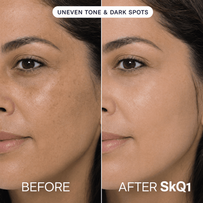 SKQ1 Serum