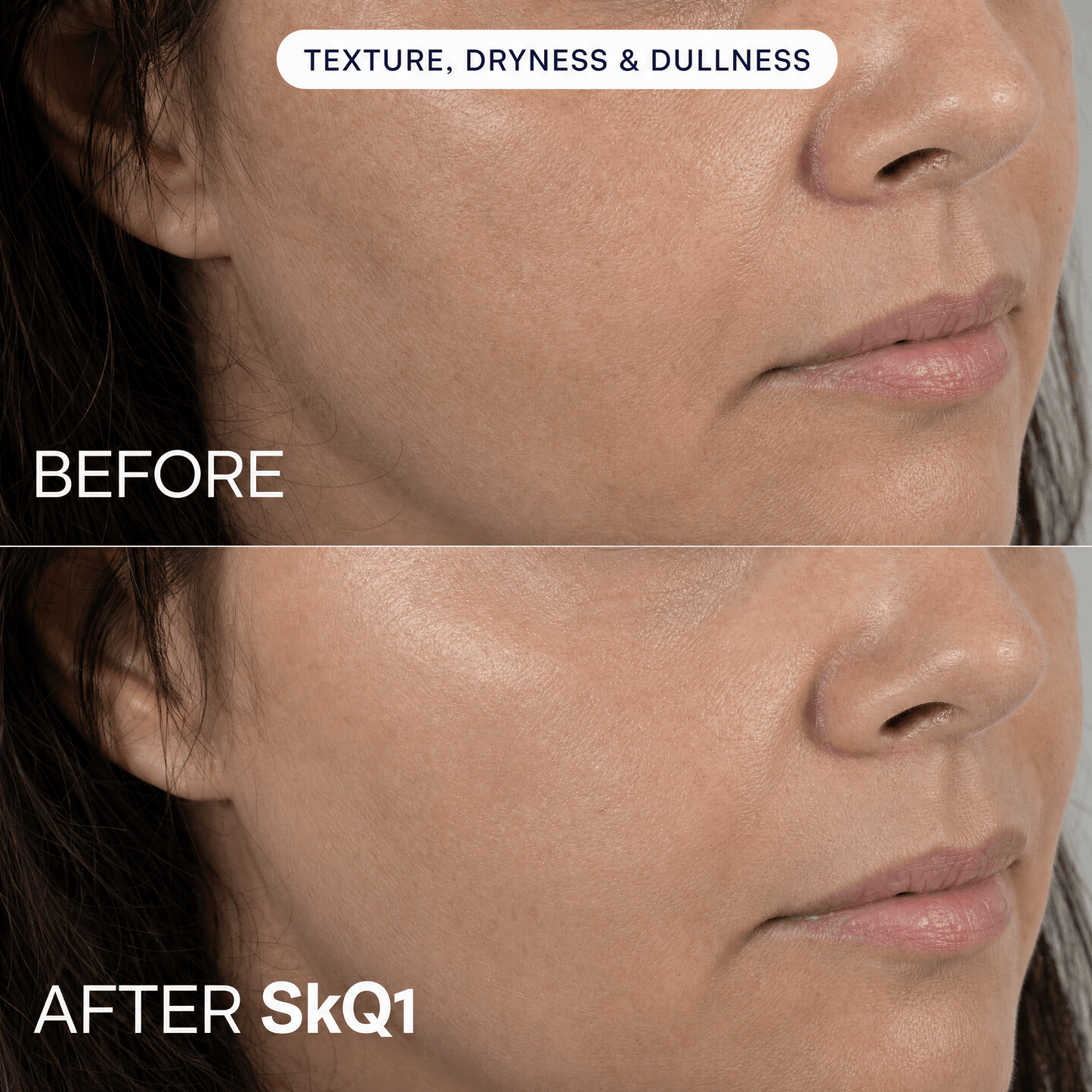 SKQ1 Serum